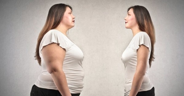 Tüp Mide Ameliyatı Nedir? Tüp Mide Ameliyatı Nasıl Yapılır?